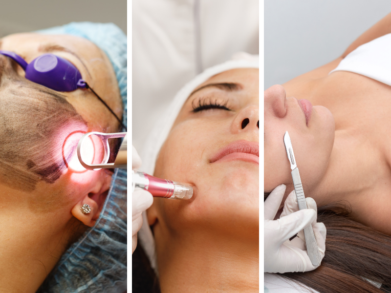 Tratamientos Avanzados