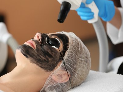 Técnica Hollywood Peel